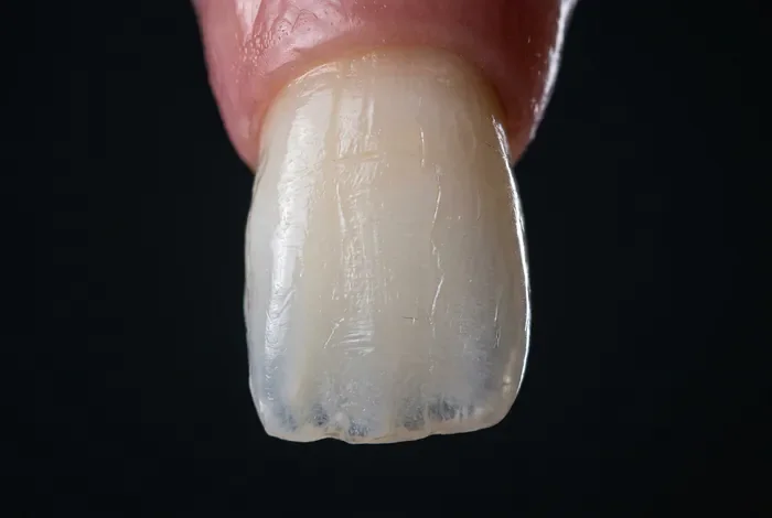 Comment blanchir une dent dévitalisée naturellement en 2026 Gros plan macro sur la texture naturelle d'une dent humaine