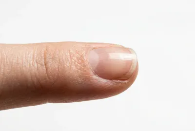 Miniature ongle endommagé pour article santé